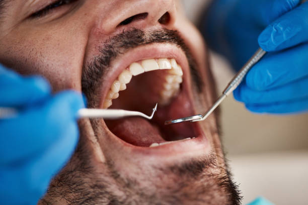 Best Emergency Dental Care for Sports Injuries in Aberdeen, ID